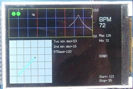 DIY Arduino based 'Pulse and Poincare' display uses KYTO 5.3 kHz receiver