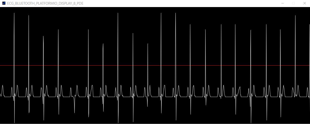 DIY stored sampleof  ECG to 'PROCESSING 4', 250 SPS