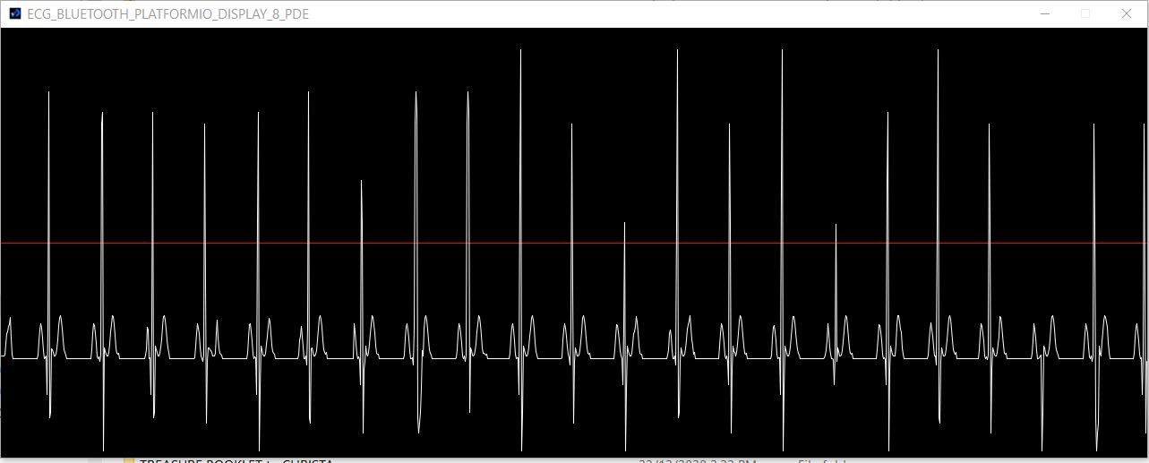 DIY stored sampleof  ECG to 'PROCESSING 4', 500 SPS