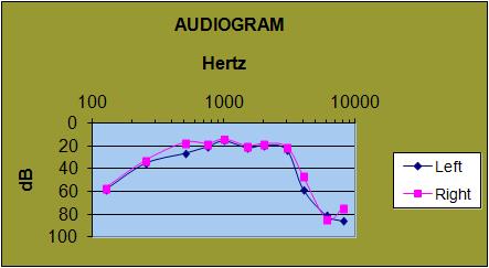 DIY audiogram project